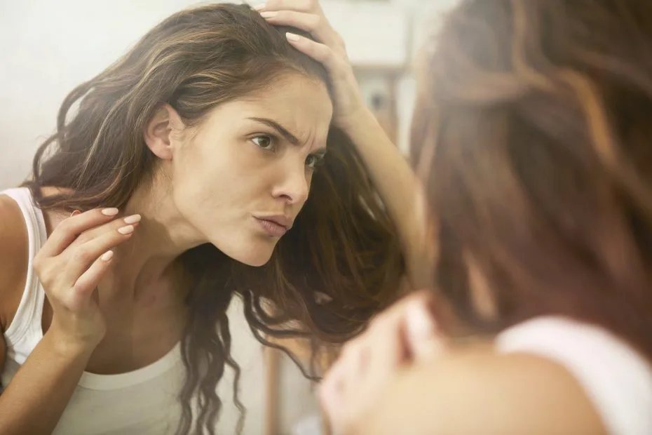 BeautyMatters blog - Dark spots